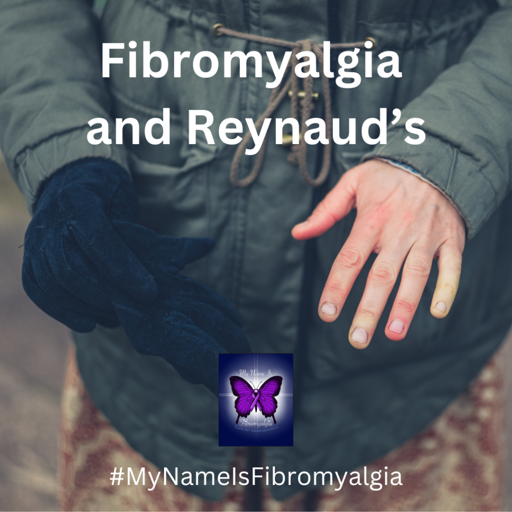 Fibromyalgia and Reynaud’s